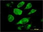 SSR4 Antibody (monoclonal) (M01)